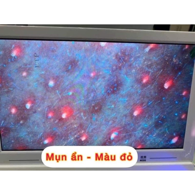 [ Freeship ]Máy soi da IPAD 11 inch- 3 chế độ soi- rõ nét- nhỏ gọn-tiện lợi