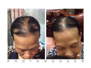 Tinh dầu bưởi rừng