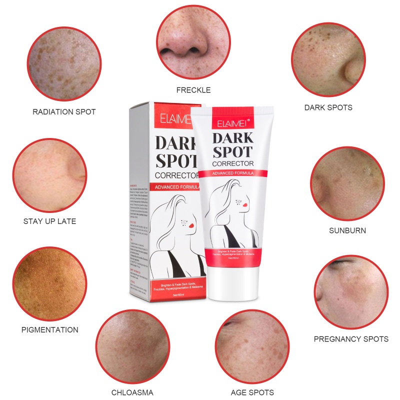 Kem Hỗ trợ giảm tàn nhang Làm Trắng Da Và Loại Bỏ Nám Tàn Nhang Hiệu Quả