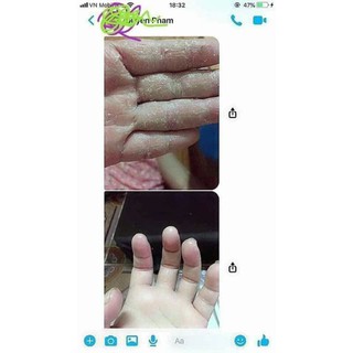 Kem dưỡng da đa năng Glysolid nội địa Đức