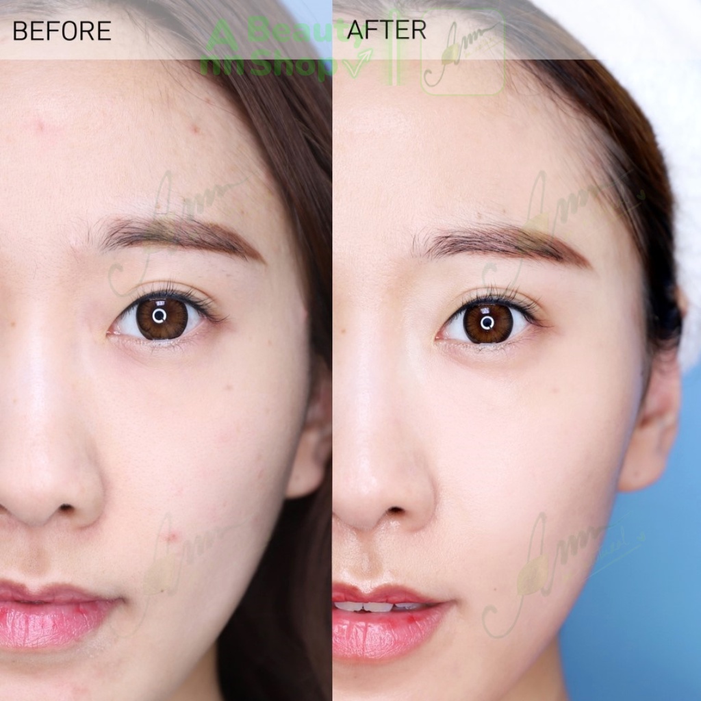 Kem dưỡng ẩm cho da mụn, da nhạy cảm Dr.G R.E.D Blemish Clear Soothing Cream