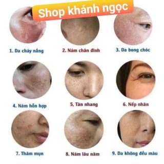 Kem (Nám tàn nhang) Hương Thị Cao cấp 10g