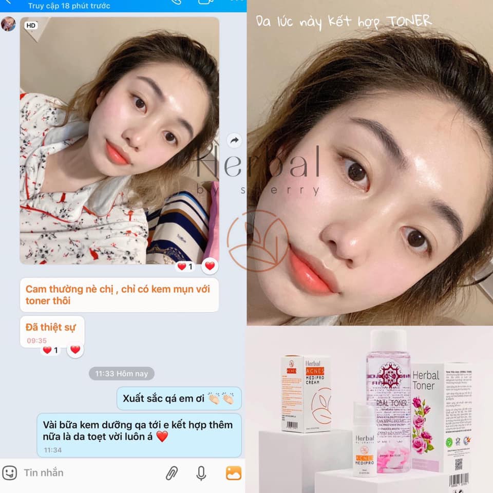 HERBAL ACNES MEDIPRO CREAM - Kem mụn thảo dược (15ml) | BigBuy360 - bigbuy360.vn