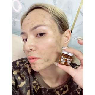 Thay da sinh học krauter peel zellkur 7 hàn quốc