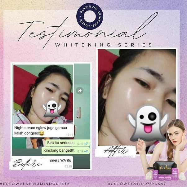 Son môi Eglow PLATINUM FREE LIP CREAM HANASUI / E GLOW PLATINUM BPOM (mã 0029) | BigBuy360 - bigbuy360.vn