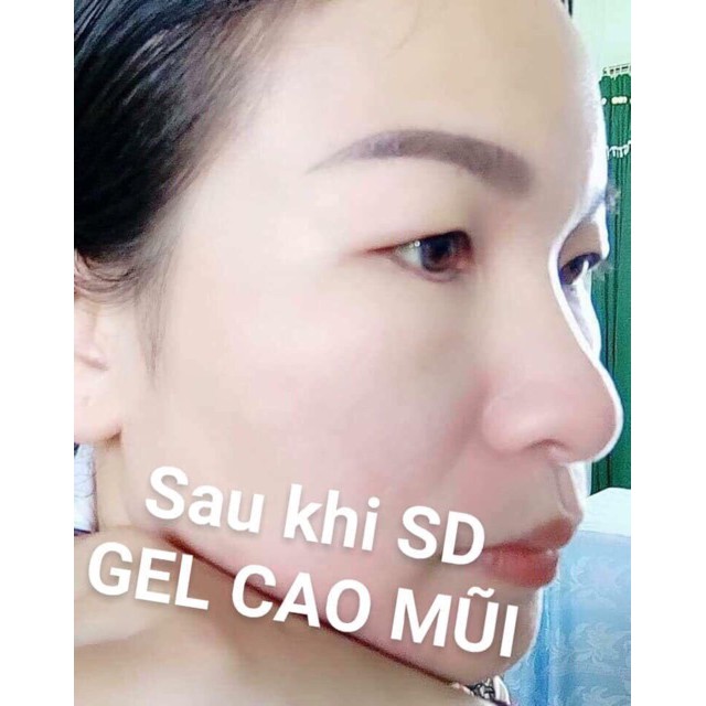 Gel Cao Sống Mũi 🎀 FREESHIP TỪ 450K 🎀Gel cao sóng mũi thảo dược.