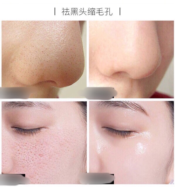 ] Serum Lactobionic Acid,Thu Nhỏ Lỗ Chân Lông, Cải Thiện Tình Trạng Loại Bỏ Mụn Đầu Đen, Làm Đều Màu Giúp Da Trắng Sáng