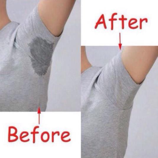 Miếng dán thấm hút mồ hôi nách, khử mùi, diệt khuẩn