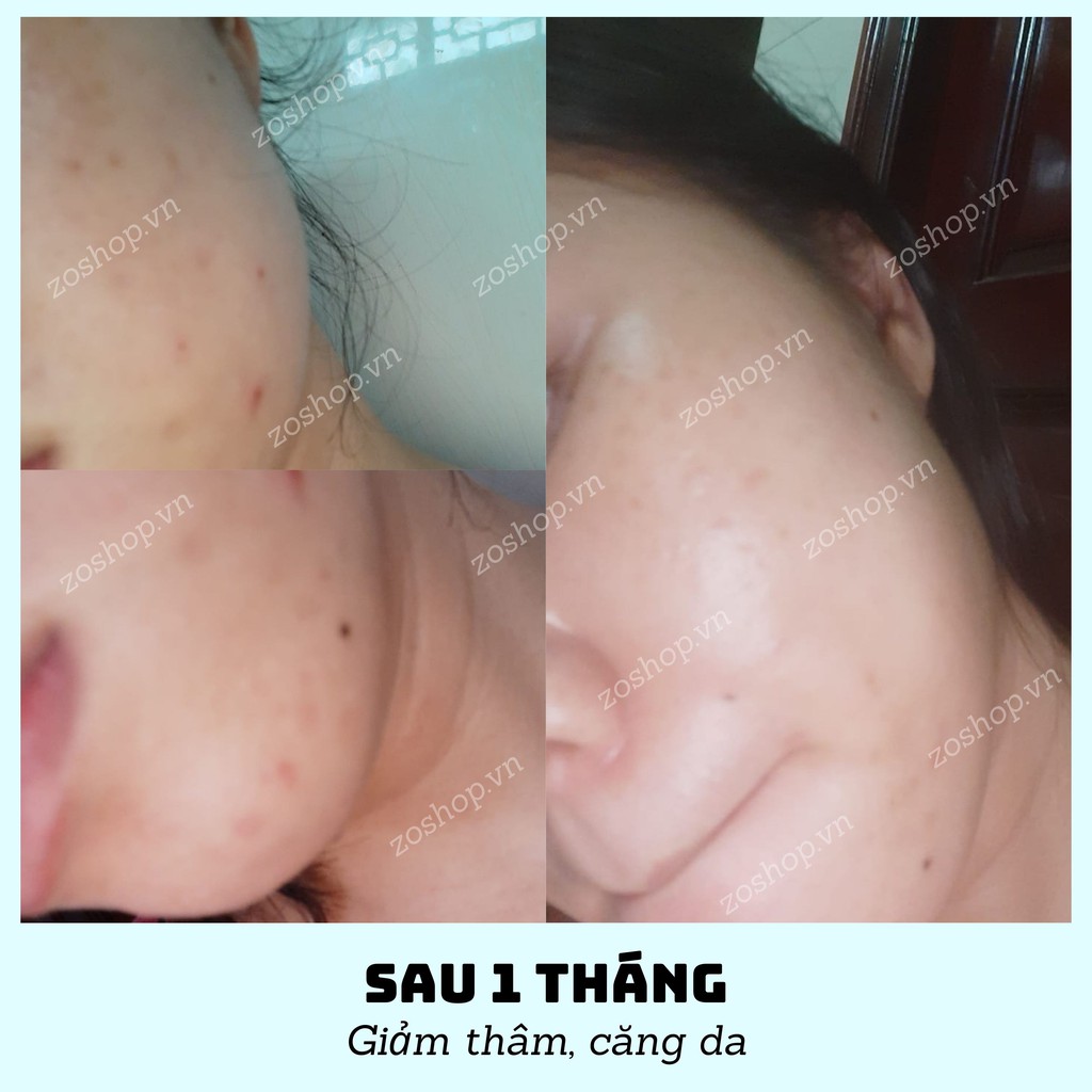 Serum Vàng Fracora Dưỡng Trắng Hồng, Giảm Thâm, Căng Bóng Fracora Golden VC Extract Serum (30ml)