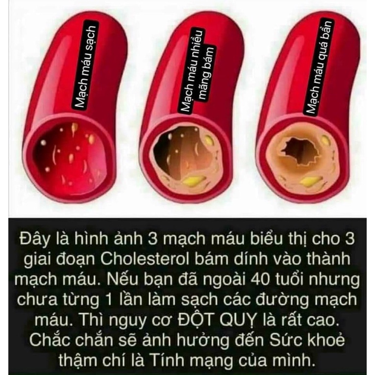 OMEGA-3 --Thực phẩm bảo vệ sức khỏe GENERAL BALANCE OMEGA-3