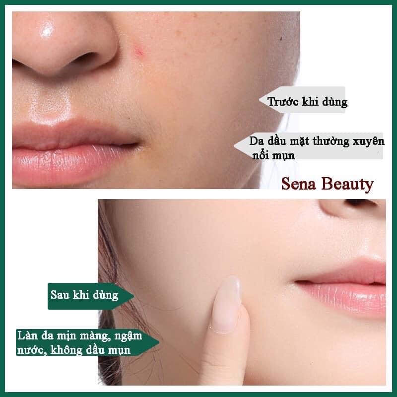 Toner dạng hủ