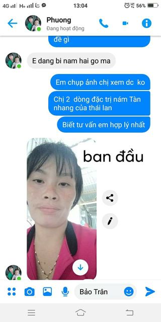 [xả kho 3 ngày] BỘ SP CLOBETAMIL G  NÁM, MỤN, TÀN NHANG Mua ngay kẻo hết. | BigBuy360 - bigbuy360.vn