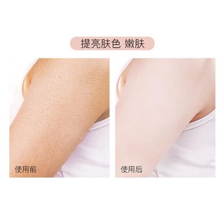 [SẴN] Muối tắm giảm mụn Anfany
