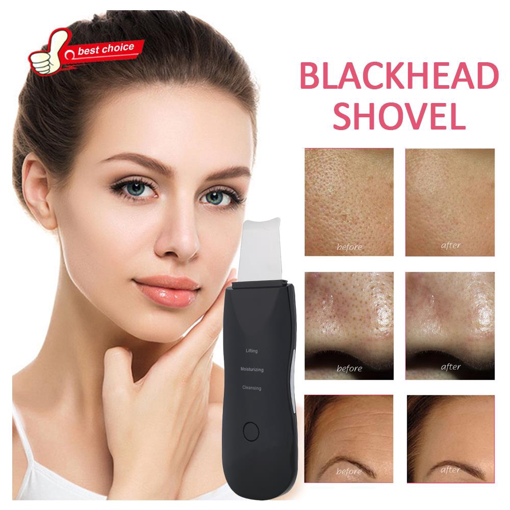 Máy cà da hút mụn làm đẹp hiệu quả màu đen | BigBuy360 - bigbuy360.vn