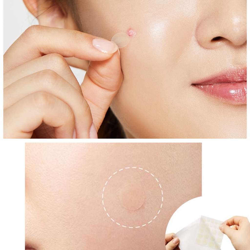 Miếng Dán Mụn Mayan Care Chính Hãng