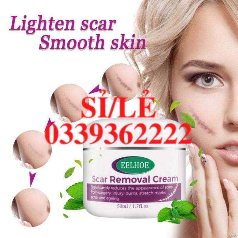 [Hàng mới về] Kem loại bỏ sẹo làm mờ vết rạn da phục hồi làn da 50ml  HAIANHSHOP