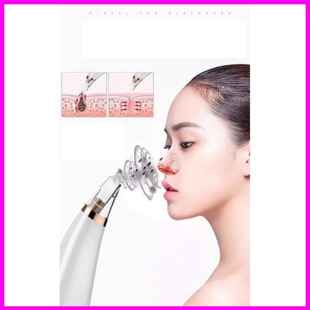 (Giá Tốt Nhất) Máy Hút Mụn Đầu Đen Black Head Beauty Testor Cầm Tay Cao Cấp (Không Lo Mụn Đầu Đen) (Chất Lượn