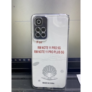 Ốp Xiaomi Redmi Note 11 Pro/ Plus 5G dẻo trong bảo vệ Camera