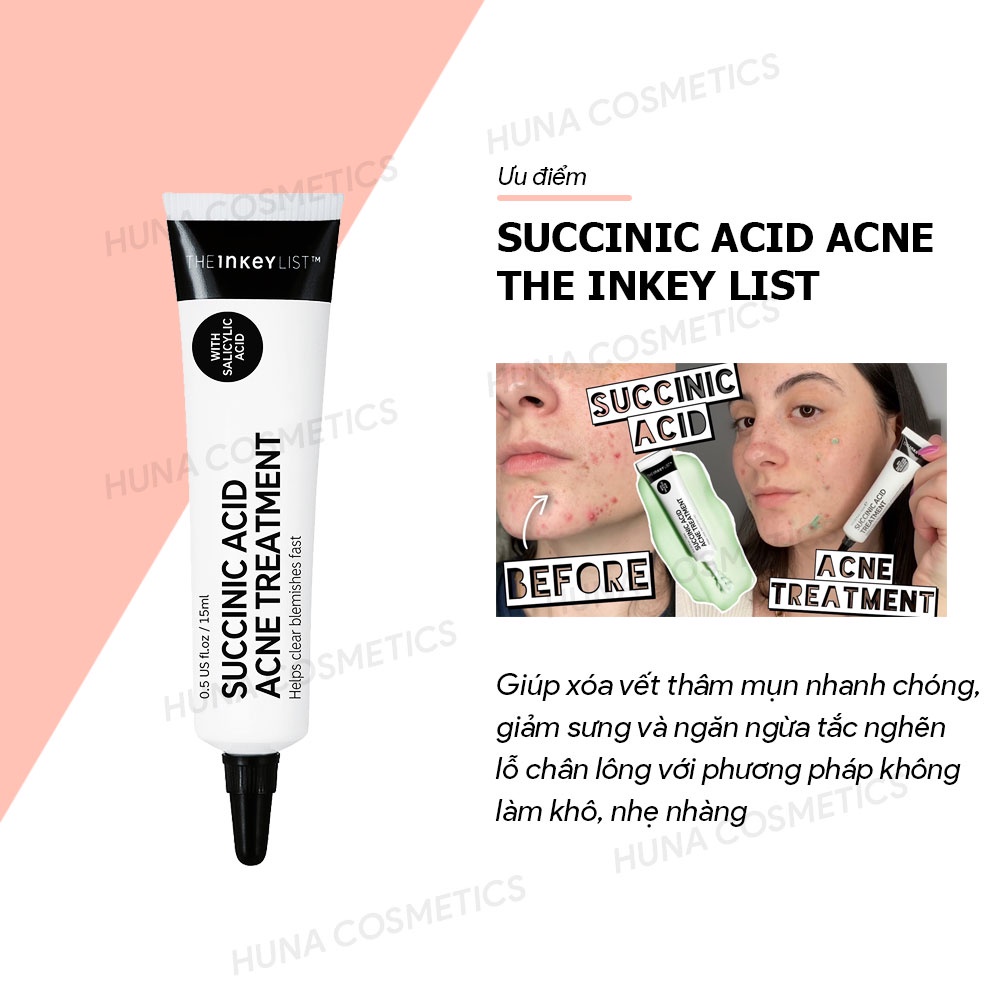 [BILL SEPHORA] KEM CHẤM MỤN SUCCINIC ACID ACNE TREATMENT THE INKEY LIST 15ML