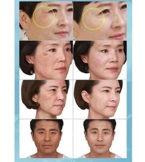 SERUM DONGSUNG CHO DA NÁM
