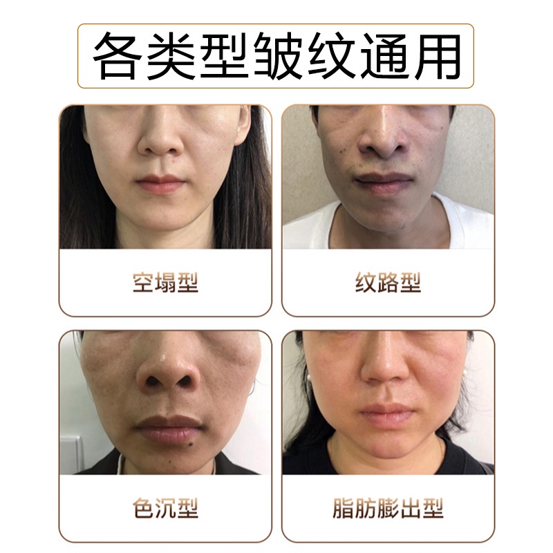 Bột Collagen Làm Mịn Nếp Nhăn Và Làm Săn Chắc Da Mặt