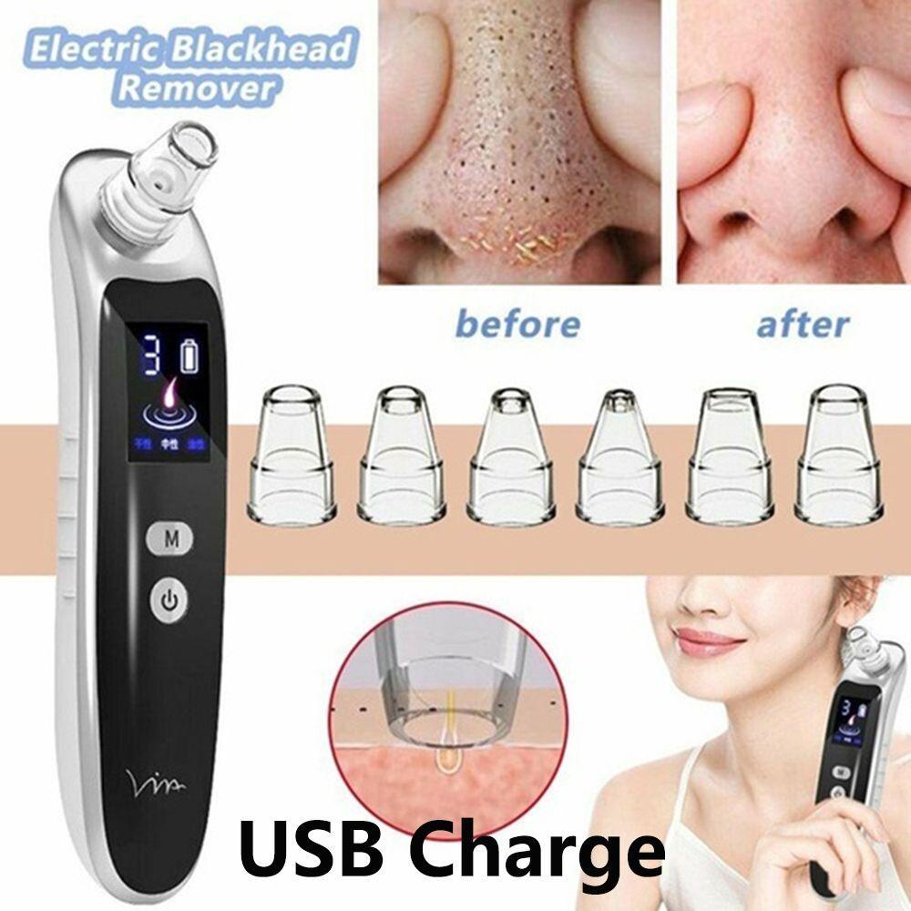 Máy Hút Mụn Đầu Đen Làm Sạch Lỗ Chân Lông