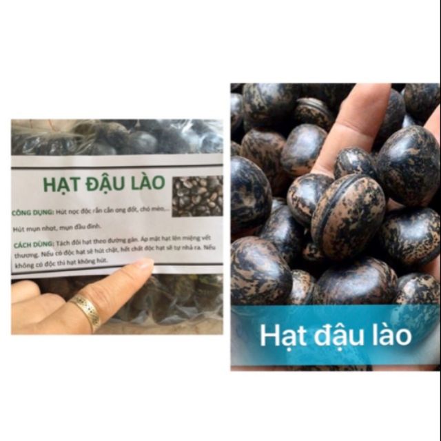 COMBO 10 HẠT ĐẬU LÀO ( HẠT HÚT ĐỘC )