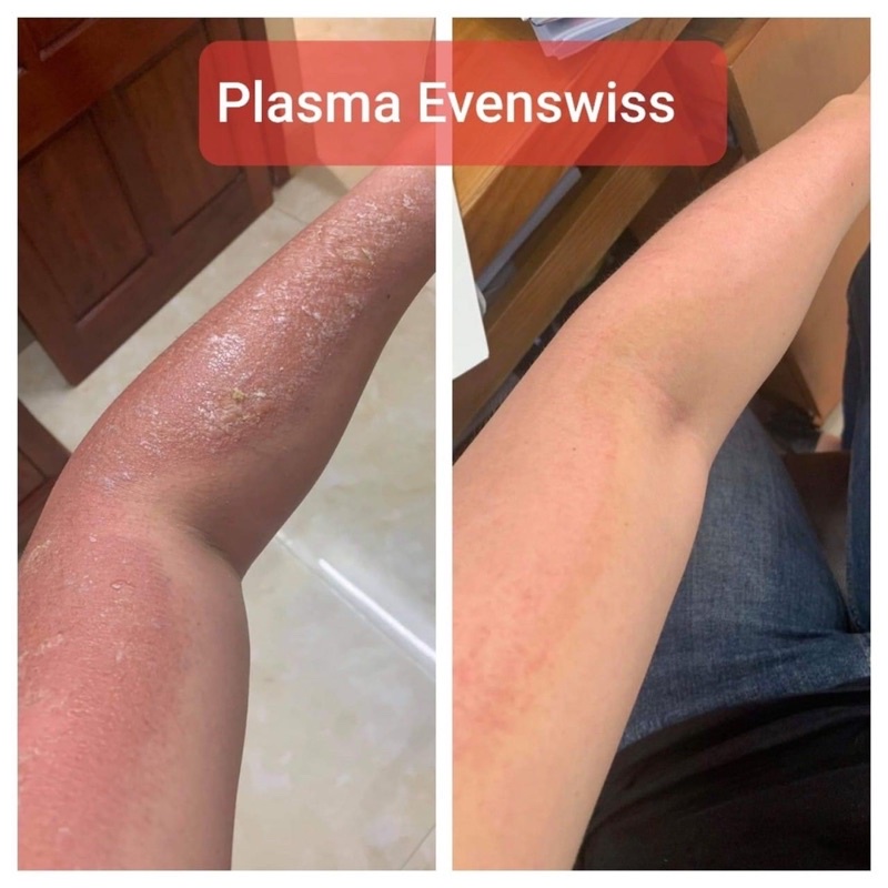 Huyết tương phục hồi làm dịu da Plasma Evenswiss 50ml