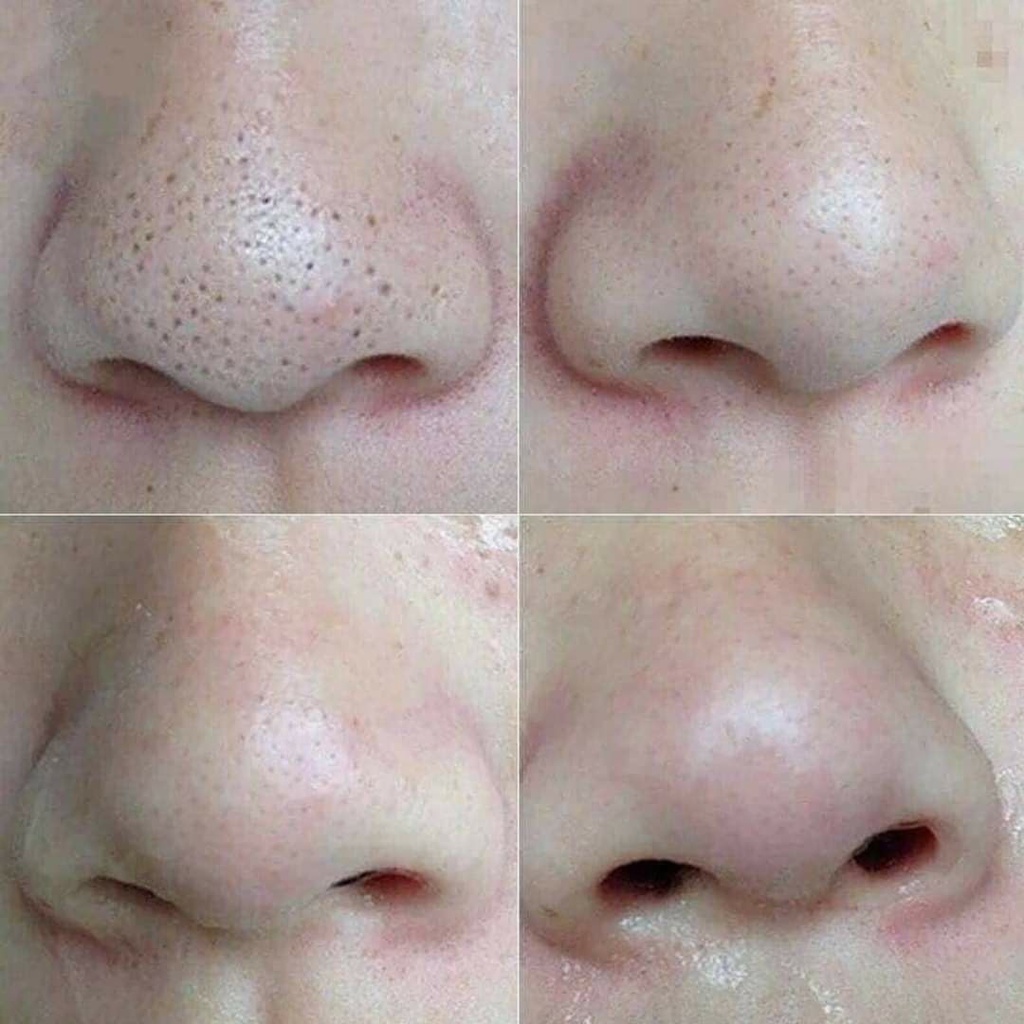 Hộp dán lột mụn mũi HATHERINE Pore Clear Nose Pack