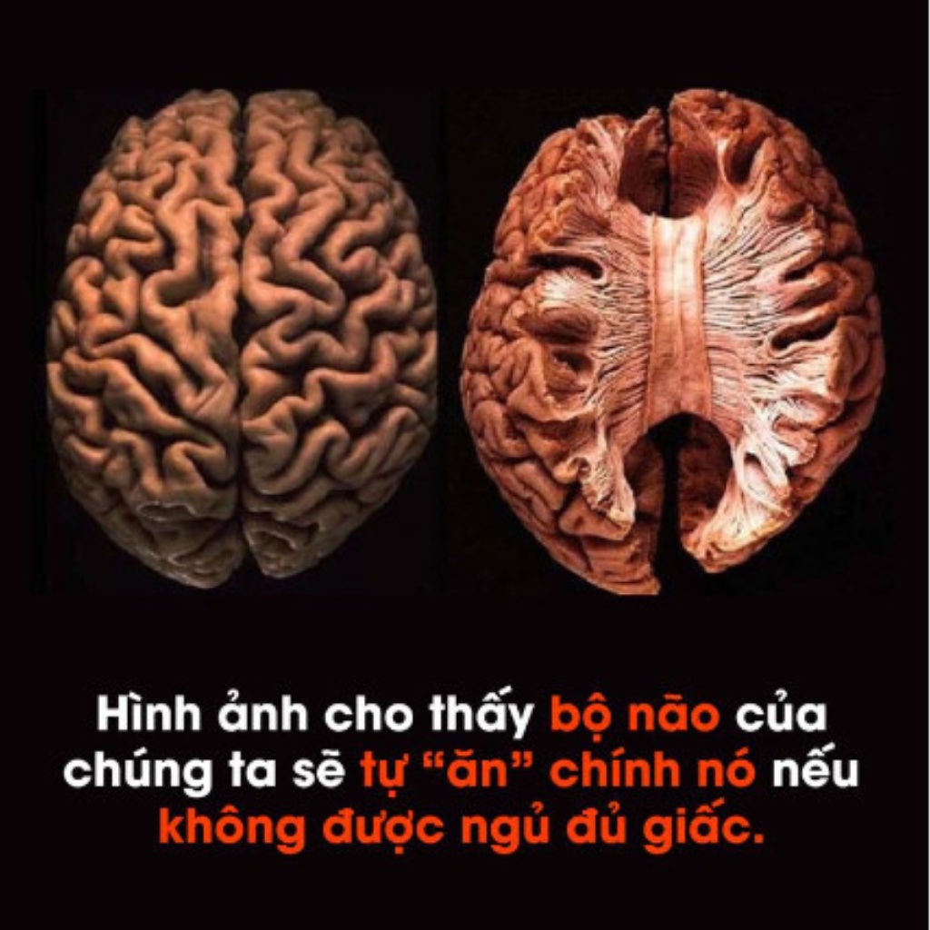 Viên uống ngủ ngon an thần CALEN giúp ngủ ngon, sâu giấc, dành cho người mất ngủ