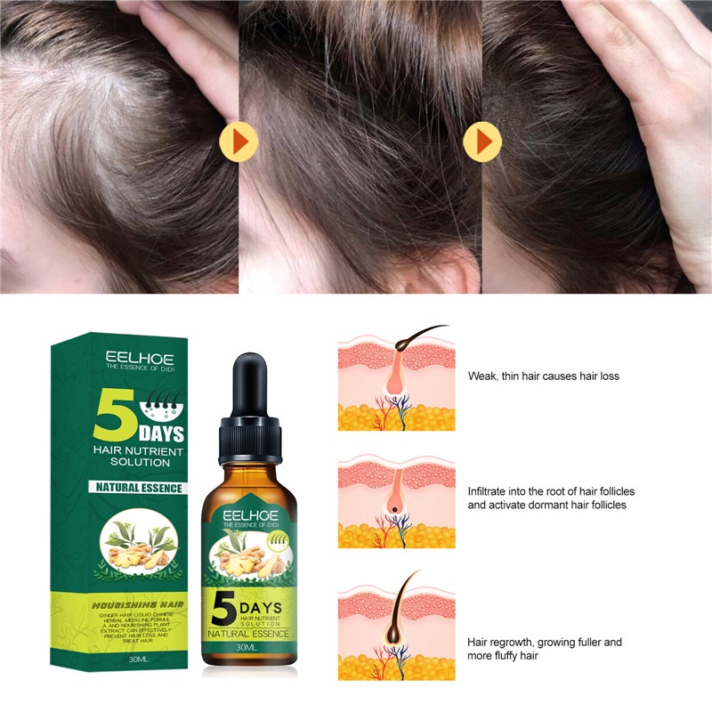 Tinh Dầu Gừng Kích Thích Mọc Tóc Chống Rụng Hiệu Quả