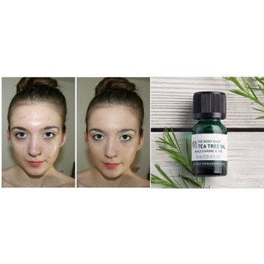 TRỊ TINH DẦU MỤN TEA TREE OIL CỦA THE BODY SHOP