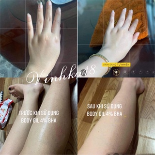 ₪ [BODY OIL] Dầu Dưỡng Sáng Bóng Da 4% BHA