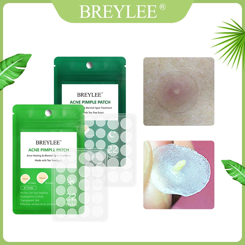Set 22 miếng dán Hỗ Trợ Giảm mụn BREYLEE sử dụng cho ngày và đêm | BigBuy360 - bigbuy360.vn