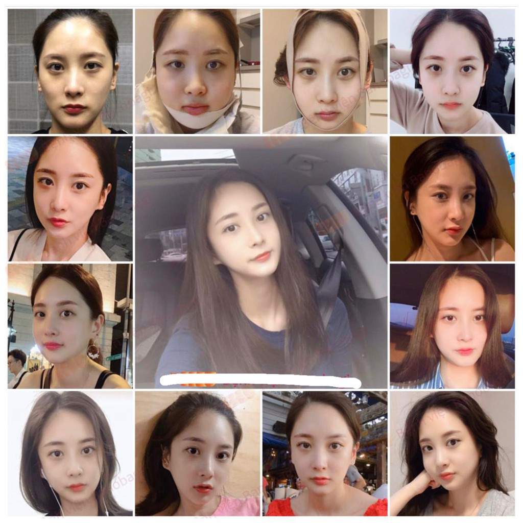 Nịt Định Hình Mặt Vline - Giảm mỡ nọng cằm của ANN CHERY 💥HÀNG CAO CẤP💥 đai nâng ANN CHERY 3017 giúp mặt thon gọn | BigBuy360 - bigbuy360.vn