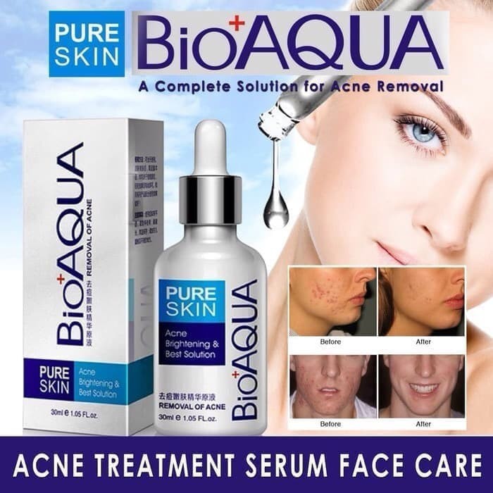 (Hàng Mới Về) Serum Trị Sẹo Mụn 30ml Bioaqua Cao Cấp