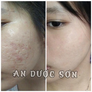 an dược sơn 50ml và bột rửa mặt