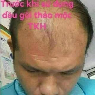 Dầu gội Trần Kim Huyền