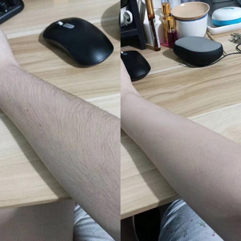 Máy Tẩy Lông Mặt Kính Mini Kèm Sạc Tiện Dụng 2022