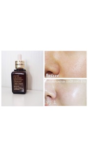Serum Estee Lauder Advanced Night Repair 15ml - 30ml