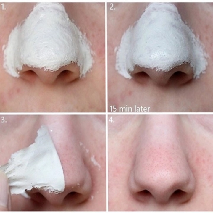 Keo Lột Mụn Cám Làm Sạch Sâu Hỗ Trợ Giảm Mụn, Gel Lột Mụn Đầu Đen Handmade