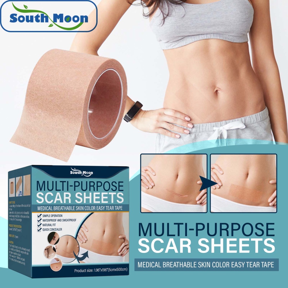 South Moon Miếng Dán Vết Sẹo Miếng Dán Che Toàn Bộ Y Tế Miếng Dán Điều Trị Vết Sẹo Băng Sửa Chữa Heby1