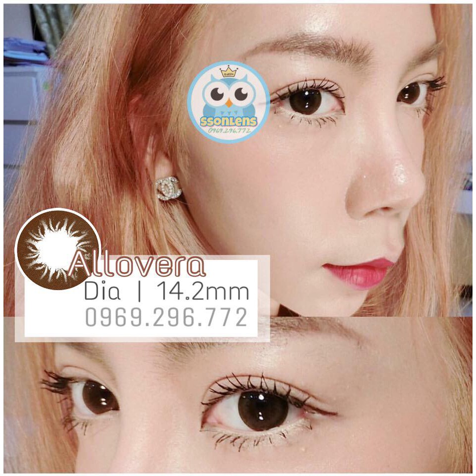 (CÓ CẬN) Mẫu Allovera 14.2mm tự nhiên- vassen contact lens Kính áp tròng