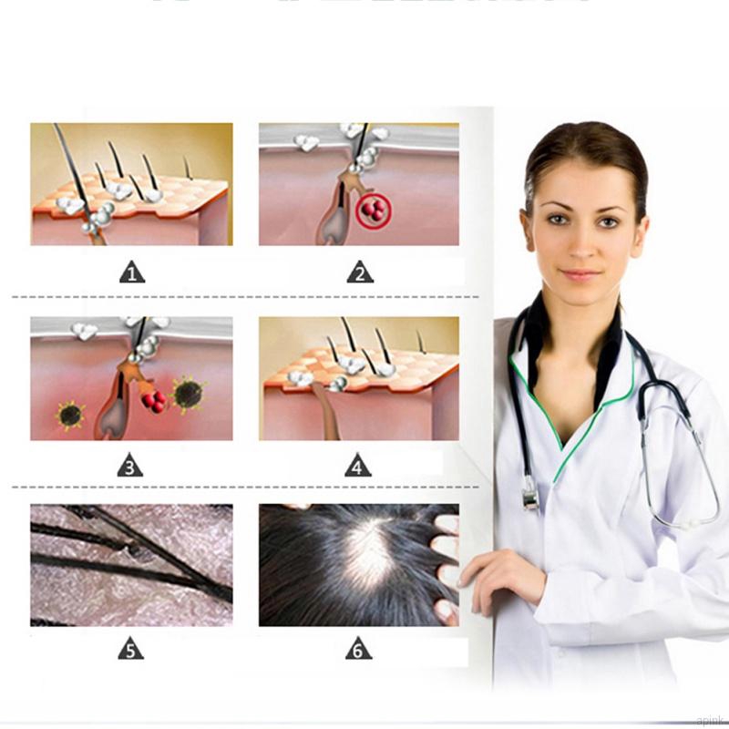 Tinh dầu chiết xuất gừng nuôi dưỡng giúp mọc tóc cho nam nữ | BigBuy360 - bigbuy360.vn