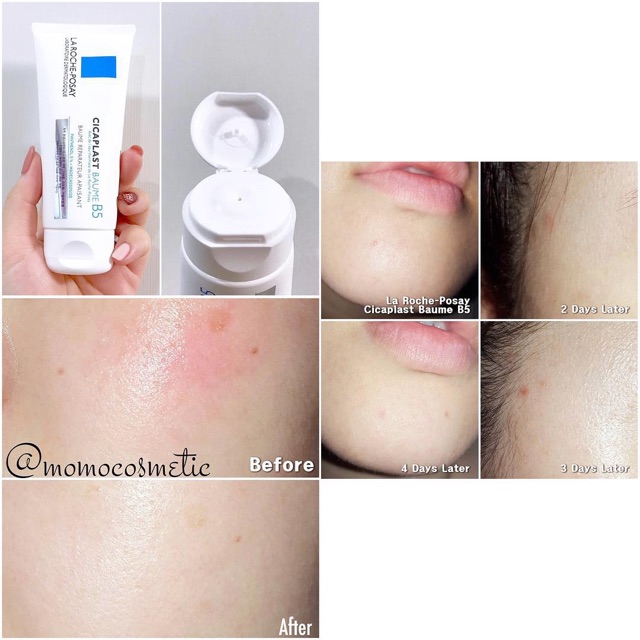 KEM DƯỠNG LA ROCHE POSAY CICAPLAST B5