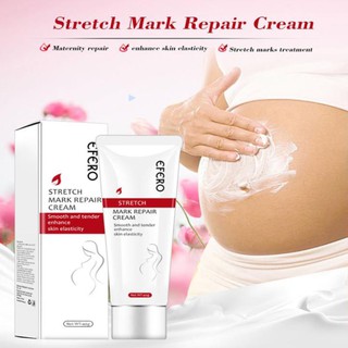 Kem Trị Rạn Da EFERO Cho Phụ Nữ Sau Khi Sinh