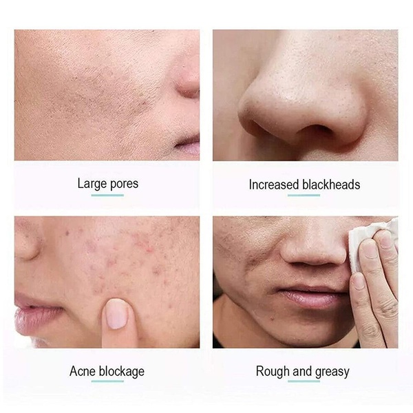 Kem tẩy tế bào chết HLLR chiết xuất quả mâm xôi tự nhiên làm sạch sâu 200g