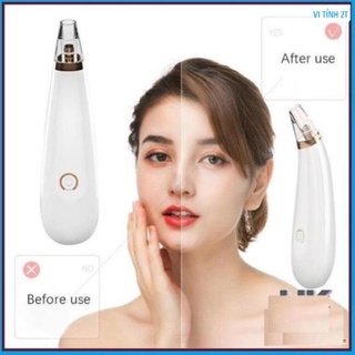 Máy hút mụn đầu đen 3 đầu BLACK HEAD DETECTOR