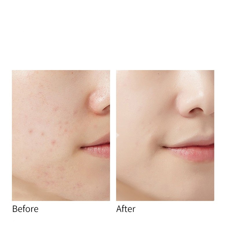 [TẶNG KÈM MÚT] Phấn nước che phủ khuyết điểm lâu trôi và làm sáng da cushion Lameila | BigBuy360 - bigbuy360.vn