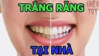 Kem đánh răng soda